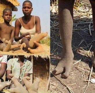 Tribu de los Vadoma: denominada como “pies de avestruz”